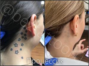 Фотография Beztattoo 2