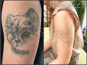 Фотография Beztattoo 3